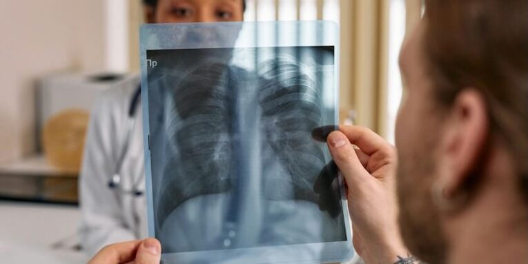 A Man Holding an X-Ray Result FEATURED IMAGE