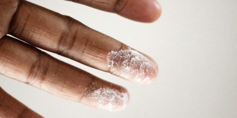 close up photo of persons finger with white powder FEATURED IMAGE