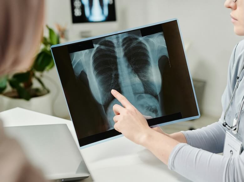hand of young doctor pointing at x-ray image of lungs during consultation and explanation results of medical examination