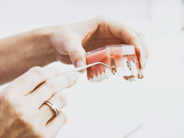 person wearing silver colored ring while holding denture
